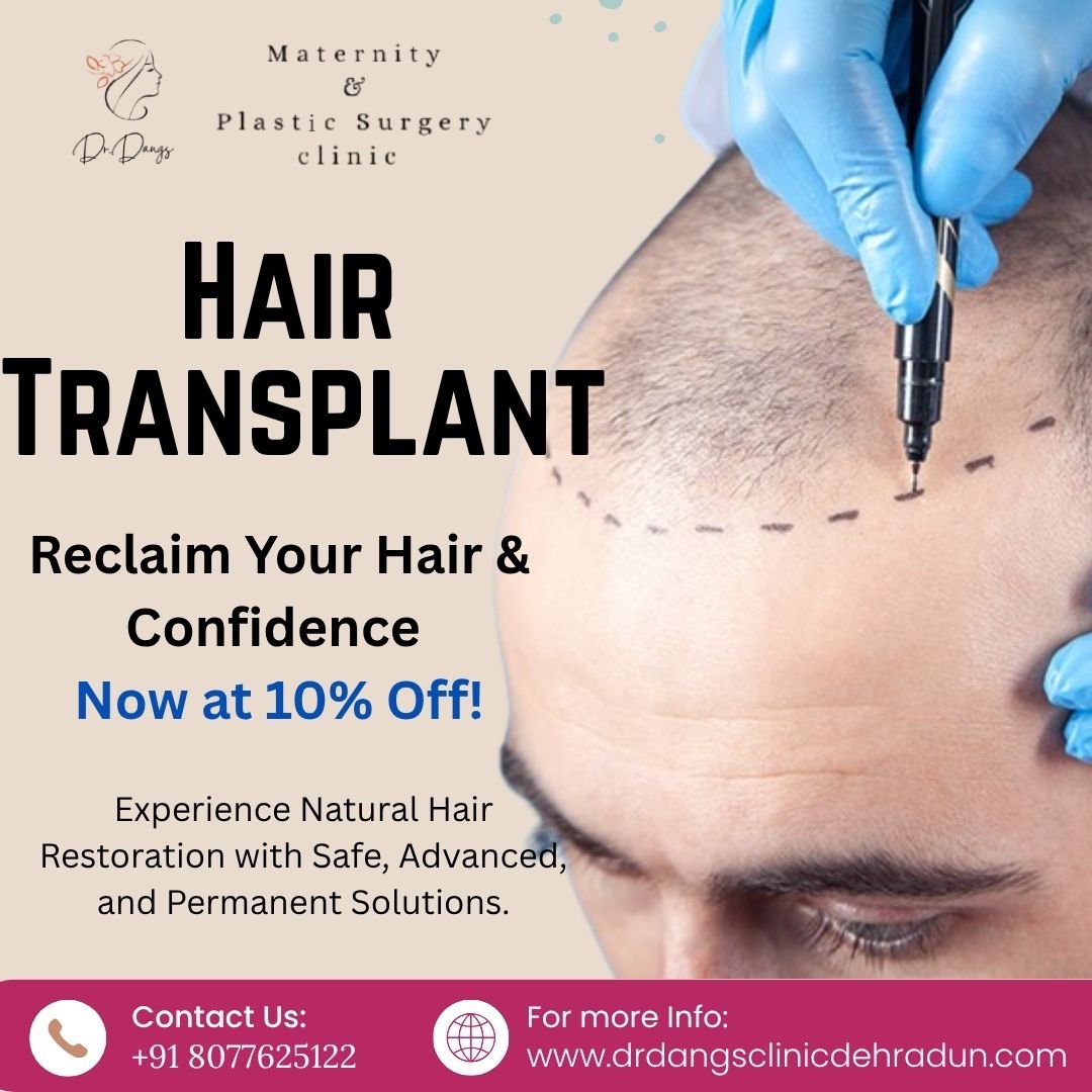 Get 10% Off on Hair Transplant
